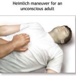 مانور هایملیخ (Heimlich Maneuver)